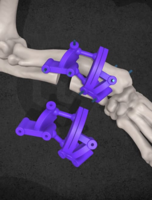 Műtéti segédeszközök