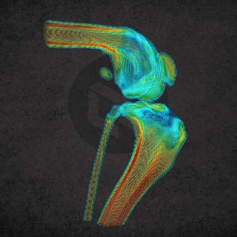 Denzitás alapú csontelemzés