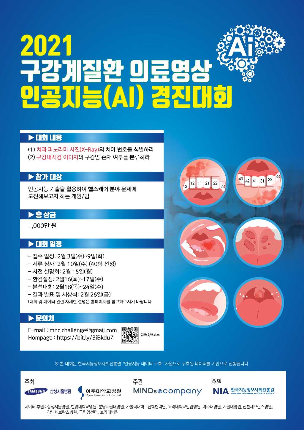 구강계질환 의료영상 인공지능(AI) 경진대회 개최