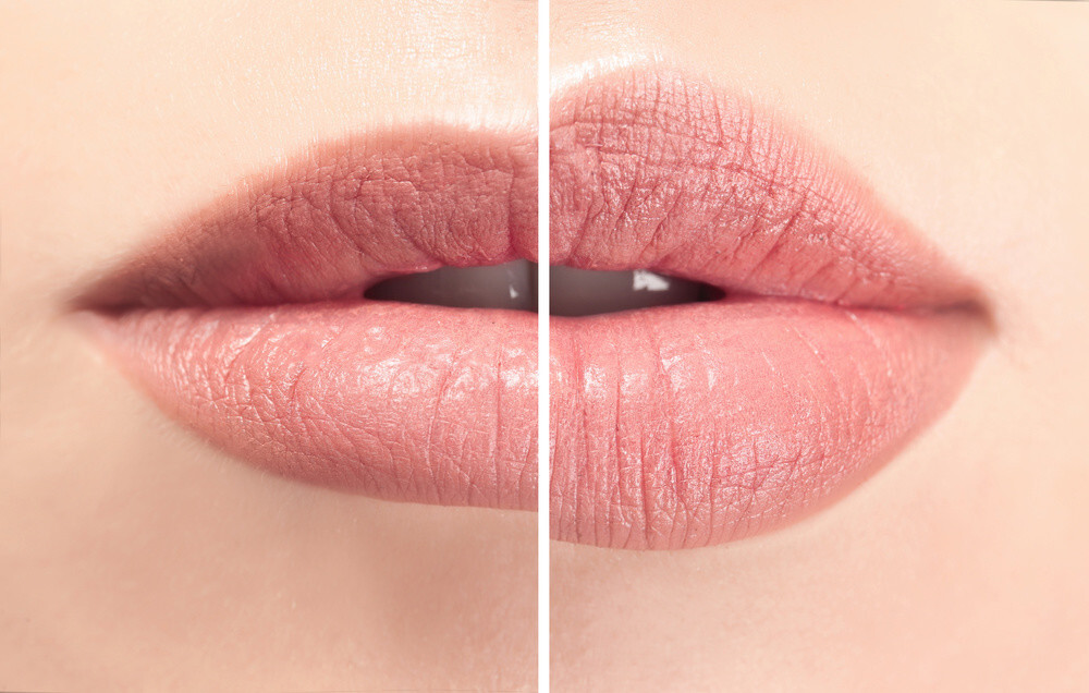 Krachaps Lips
