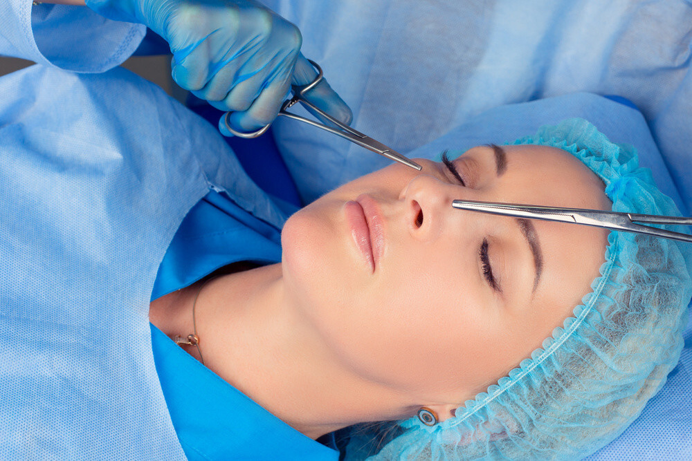 Rhinoplasty