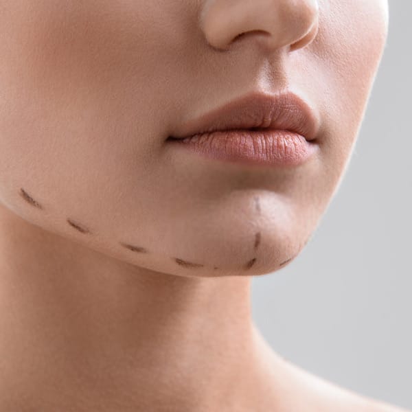 Chin Implant