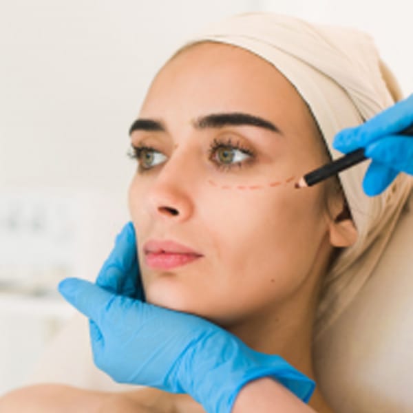 blepharoplasty