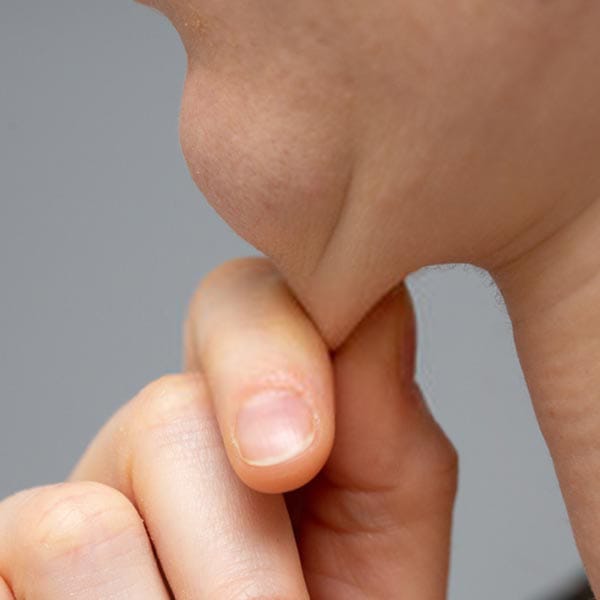 Double Chin Reduction