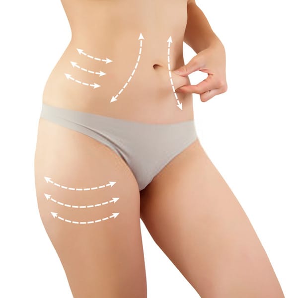Liposuction