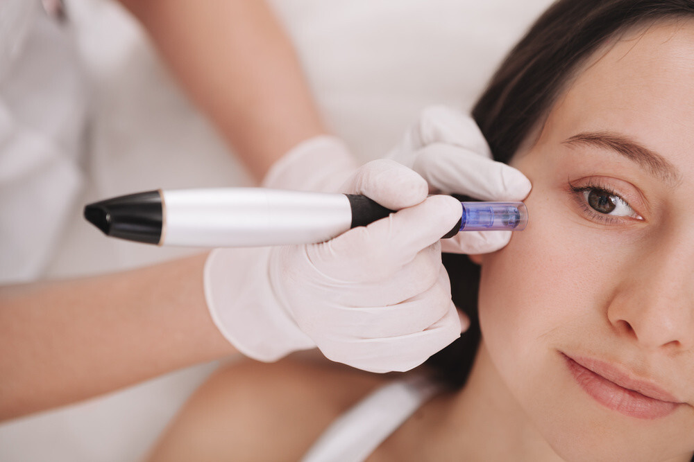 Dermapen