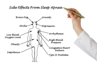 Sleep Study Sleep Apnea Test