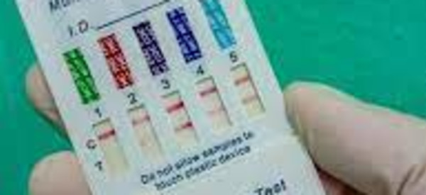 Instant 10-Panel Urine Drug Screen