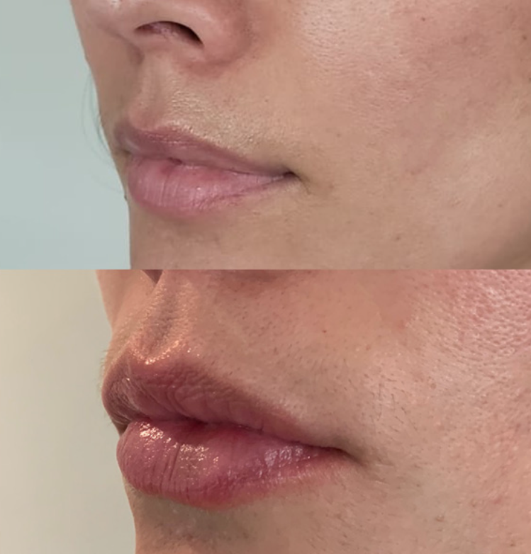 💄 Goddess✧Gloss✨Lip Plump & Glow ~ $199