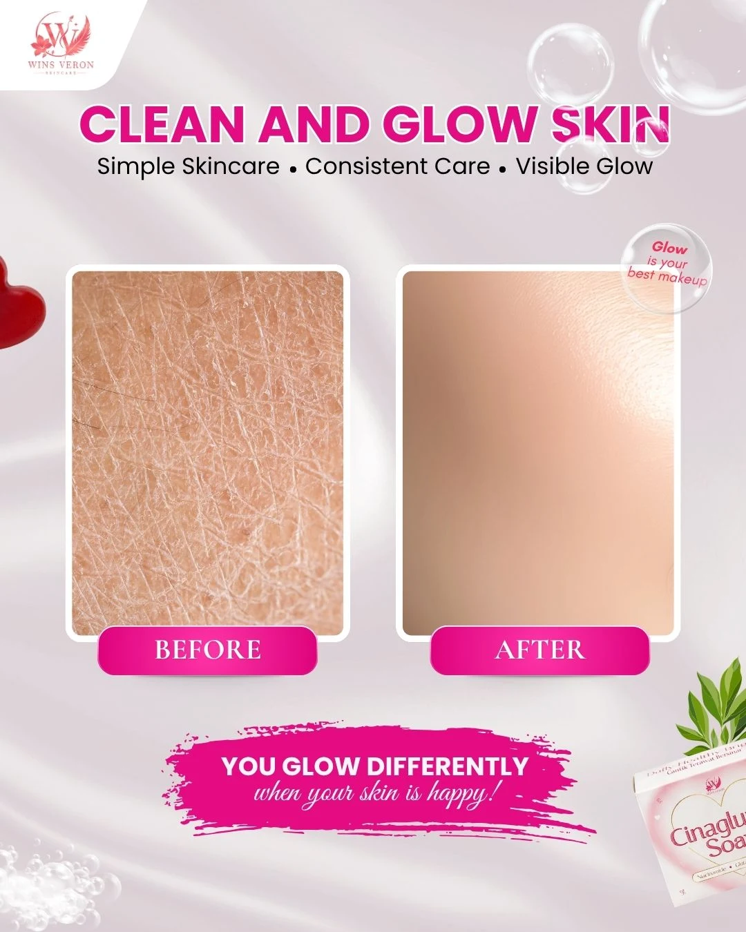 Body Booster untuk Kulit Kering: Pilih Formula yang Lebih Melembapkan