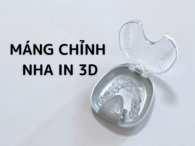 máng chỉnh nha