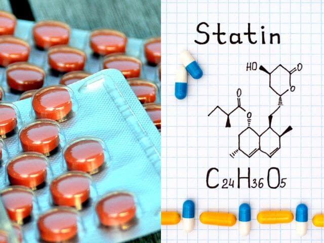 statin