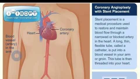 Heart & Vascular Center