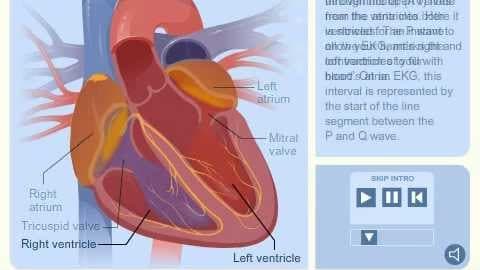 Heart Block