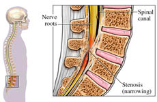 Diagram of the spine.