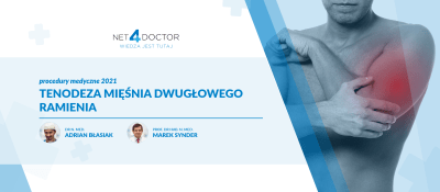 Tenodeza mięśnia dwugłowego ramienia