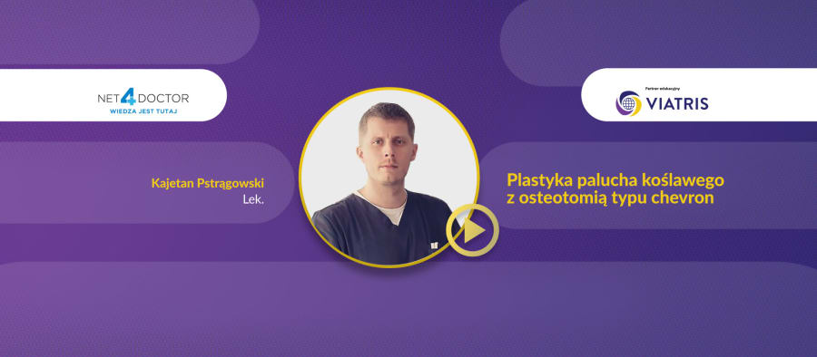 Plastyka palucha koślawego z osteotomią typu chevron