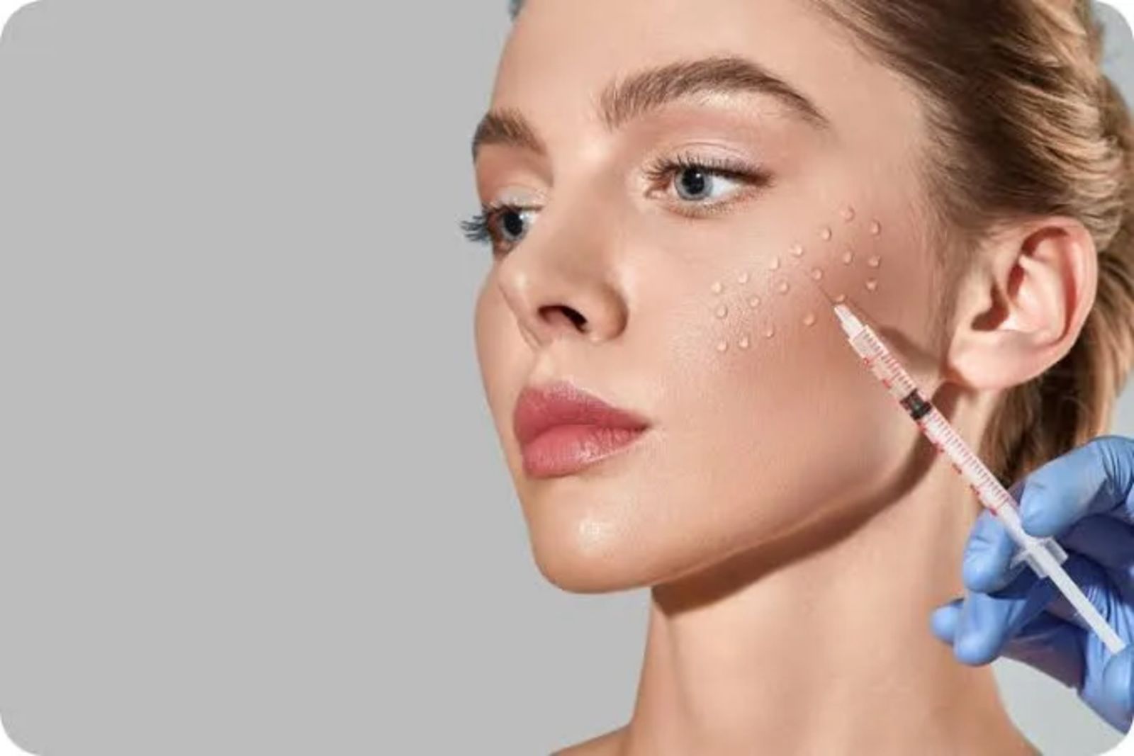 Mesoterapia facial