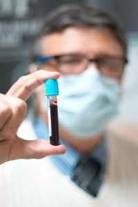 Plasma Rico en Plaquetas (PRP) - Estético Facial, Corporal y Capilar 2