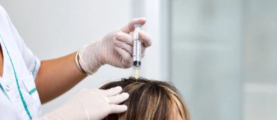 Erbium + mesoterapia capilar