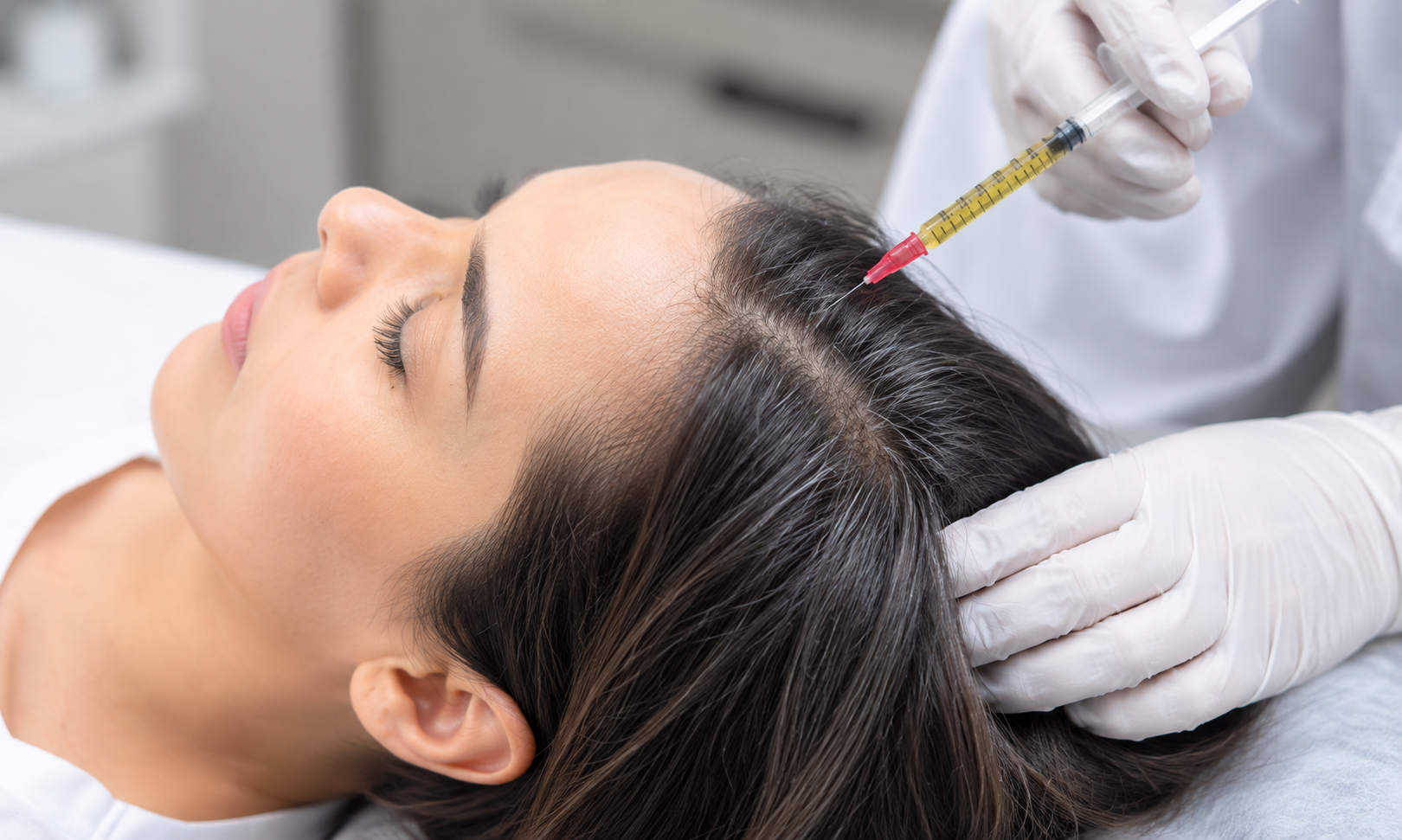 Exosome Hair Regeneration Therapy: Reawakening Dormant Hair Follicles