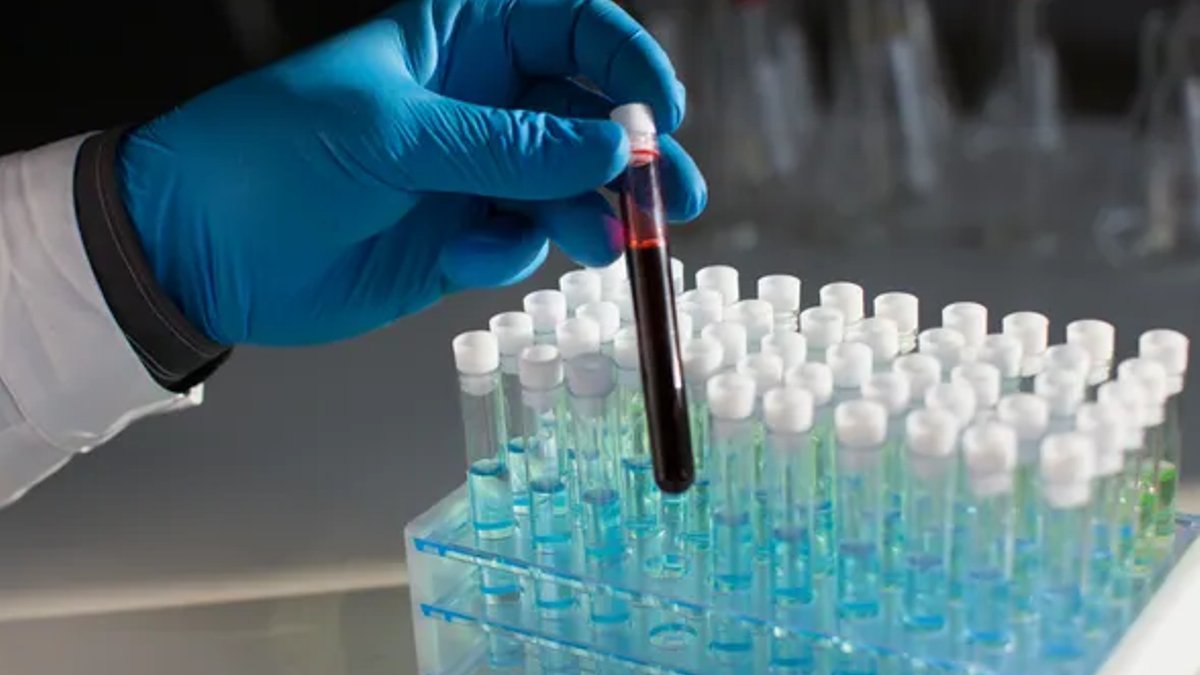Tempus Agrees to Buy Personalis for 1 Billion Tempus Agrees to Buy Personalis for 1 Billion - cancer diagnostics