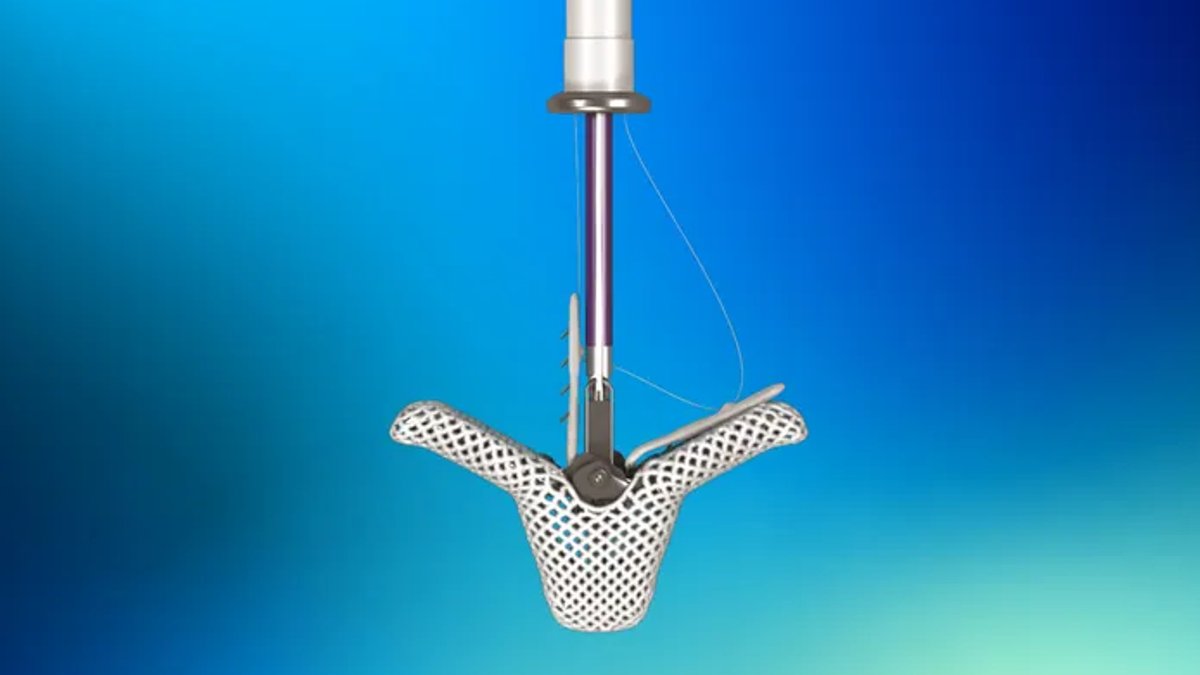Abbott Launches Study Amid Crowded Heart Valve Market - heart valve study