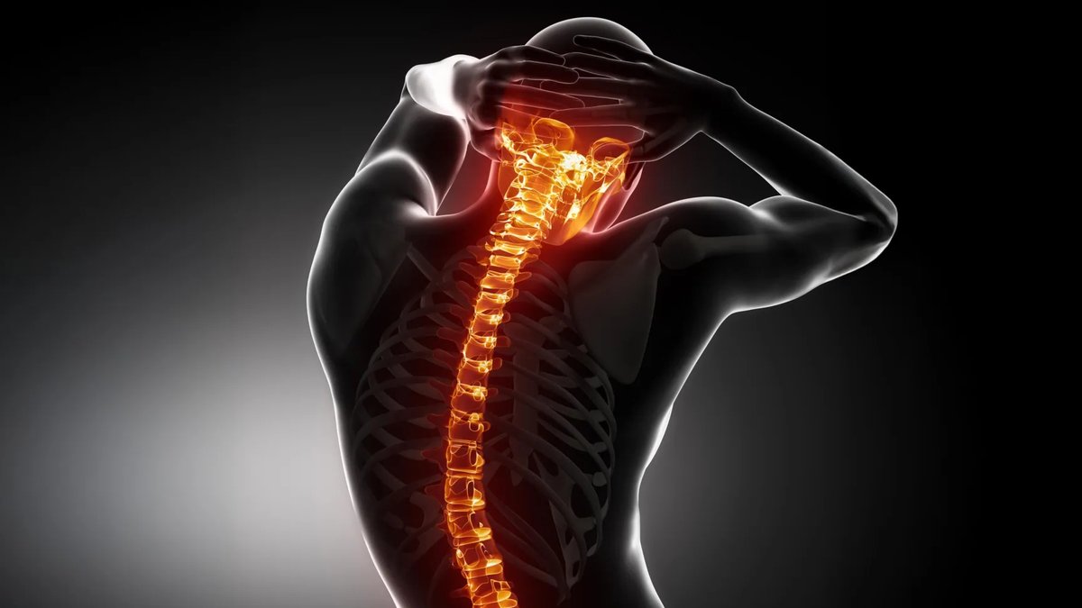 Osteoporosis drug halts spinal damage in study - osteoporosis drug