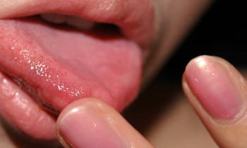 Ddxor05r9ovtbkxq2xqs