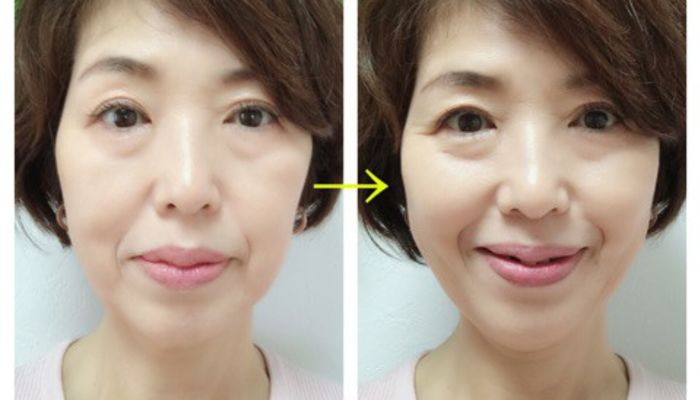 耳に輪ゴムをかけるダイエット 驚きの効果とおすすめのやり方を徹底解説