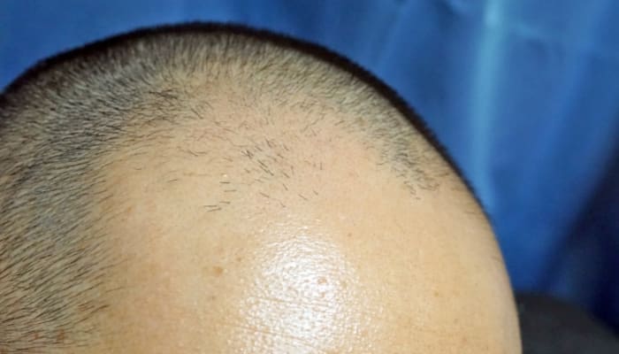 Kl9bxvepuc88hvrnfiex