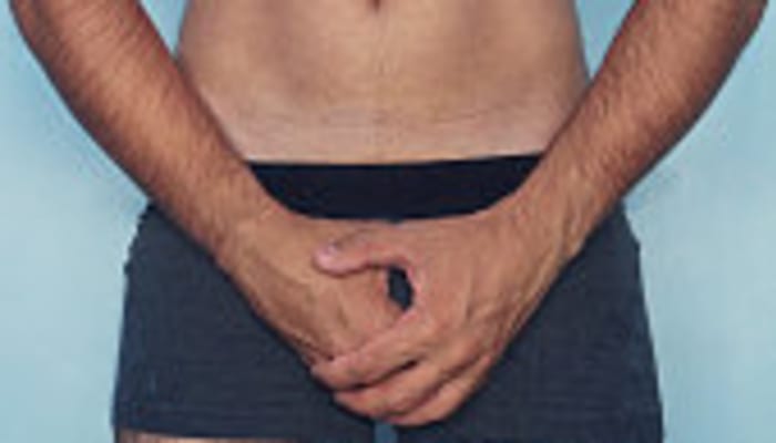 Mdqqqllwvvrmjx2sqxgx