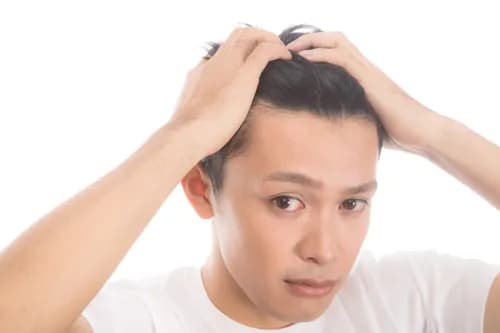抜け毛