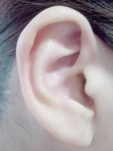 耳が小さい悩みを抱える男女必見 おすすめ解消法をご紹介