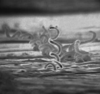 梅毒の歴史　※リンク先、病状の画像があるので閲覧注意！のサムネイル