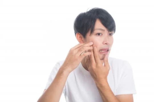 ニキビ　男性