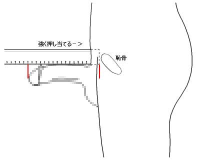 なごやEVTクリニック