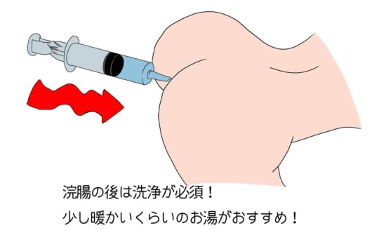 浣腸