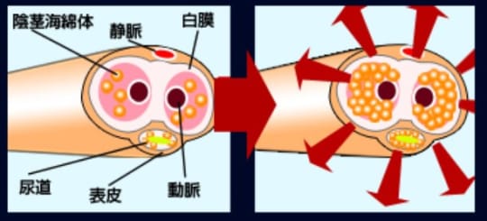 増大