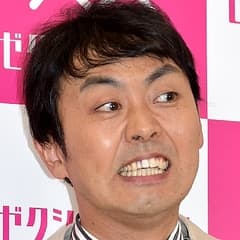 アップで映るとキツい 歯並びの悪い芸能人をまとめてみた Miima ミーマ