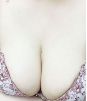 Aちゃん