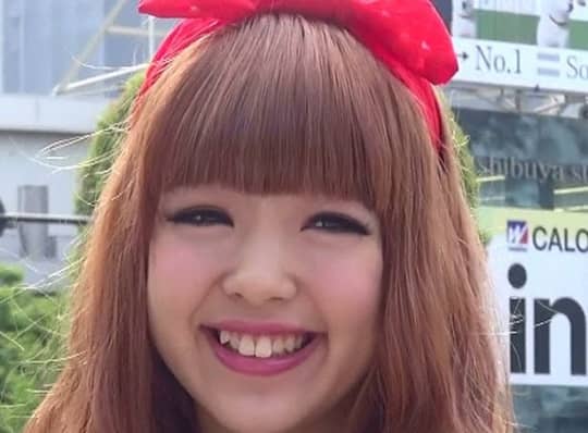 ガタガタの口内がこんなに綺麗に 歯並びを矯正した芸能人まとめ Miima ミーマ