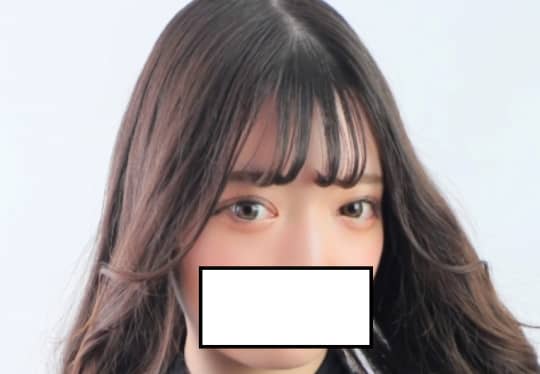 Rちゃん