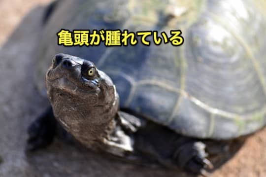 デリヘル　性病　亀頭の腫れ