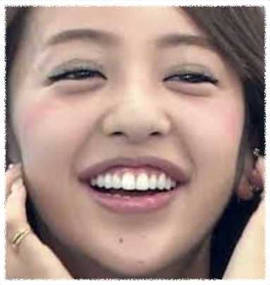 ガタガタの口内がこんなに綺麗に 歯並びを矯正した芸能人まとめ Miima ミーマ