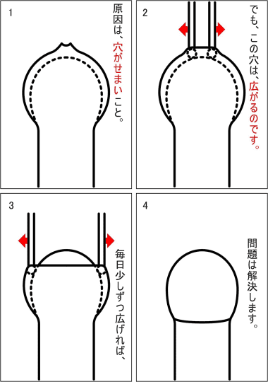 キトー君DX