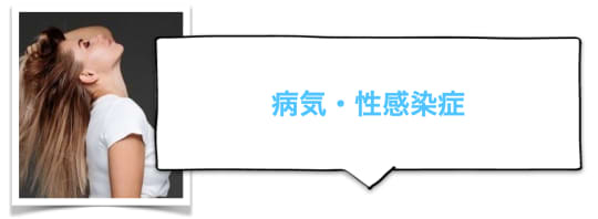 セフレとプレイするときの注意点