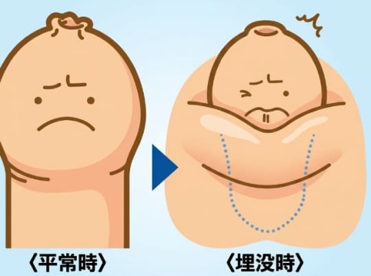 包茎 手コキ