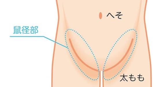 鼠径部の画像