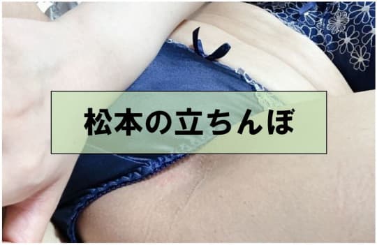 立ちんぼ